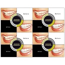 Photo Image Laser Postcards; Before & After, Accelerated Orthodontics, 100/Pk