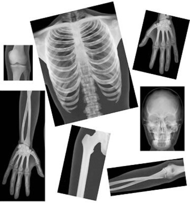 Roylco® True To Life Human X-Rays