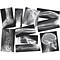 Roylco® Broken Bones X-Rays