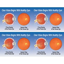 Preventive Postcards; for Laser Printer; Eye Cross Section/ Interior, 100/Pk