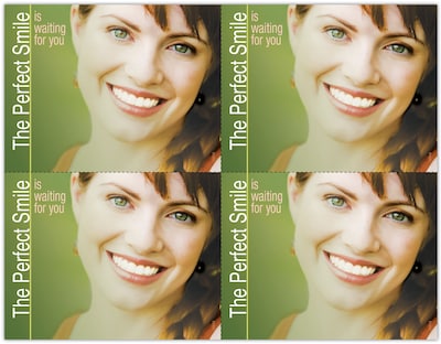 Photo Image Postcards; for Laser Printer; Perfect Smile Waiting, 100/Pk