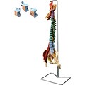 Disorders Of Spine Model