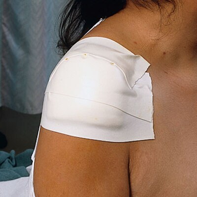 3M™ Microfoam™ Sterile Tape Patch; 4 x 7, Individually Packaged, 25 Patches/Box