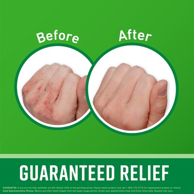 O'Keeffe's Working Hands Cream, 3 oz Tube (K0290001)