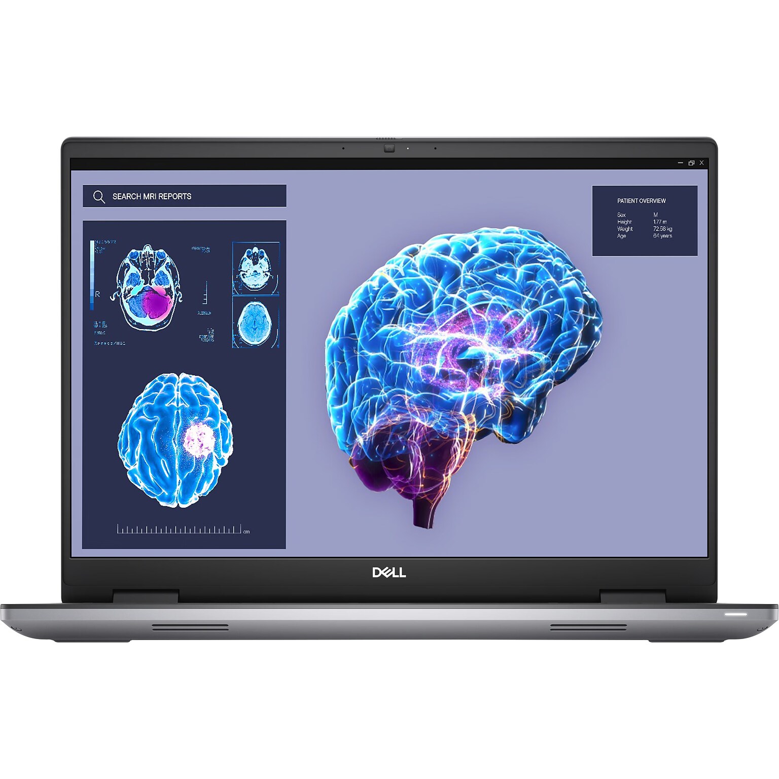 Dell Precision 7680 16 Laptop, Intel Core i9-13950HX, 64GB Memory, 1TB SSD, Windows 11 Pro (PMTF1)