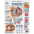 3B Scientific® Anatomical Charts; Diseases of the Eye