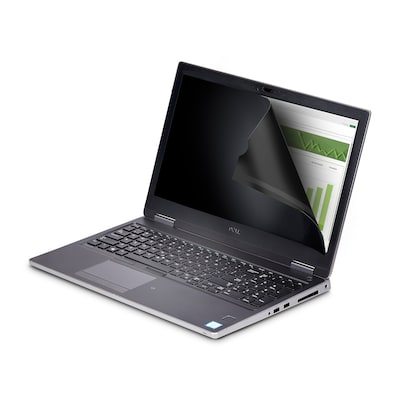 StarTech Anti-Glare Privacy Screen Filter for 14.1" Widescreen Laptop (16:10) (141T6-PRIVACY-SCREEN)