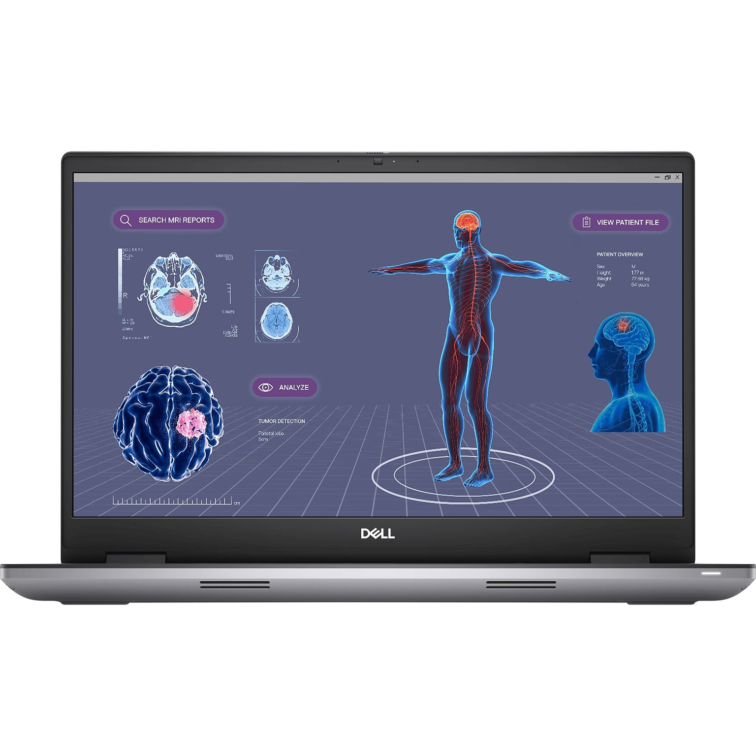 Dell Precision 7780 17.3 Laptop, Intel Core i9-13950HX, 64GB Memory, 1TB SSD, Windows 11 Pro (3GK6N)