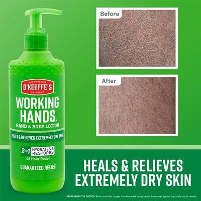 O'Keeffe's Working Hands Hand & Body Lotion, 12 oz Pump Bottle (115760)