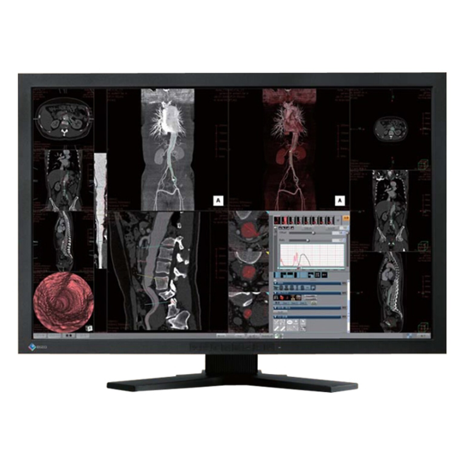 ViewSonic TD2230 22 16:9 Multi-Touch IPS Monitor