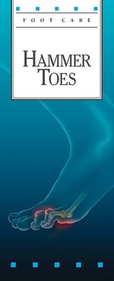 Krames® Foot Care Brochures, Hammer Toes