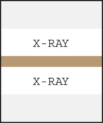 Medical Arts Press® Standard Preprinted Chart Divider Tabs; X-Ray, Tan