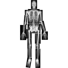 Roylco® True To Life Human X-Rays