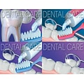 Dental Assorted Postcards; for Laser Printer; Dental Care, 100/Pk