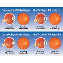 Preventive Postcards; for Laser Printer; Eye Cross Section/ Interior, 100/Pk