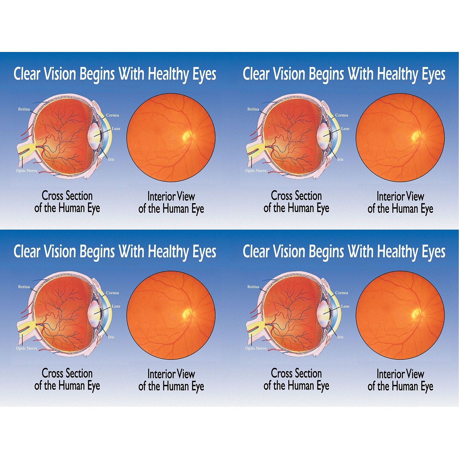Preventive Postcards; for Laser Printer; Eye Cross Section/ Interior, 100/Pk