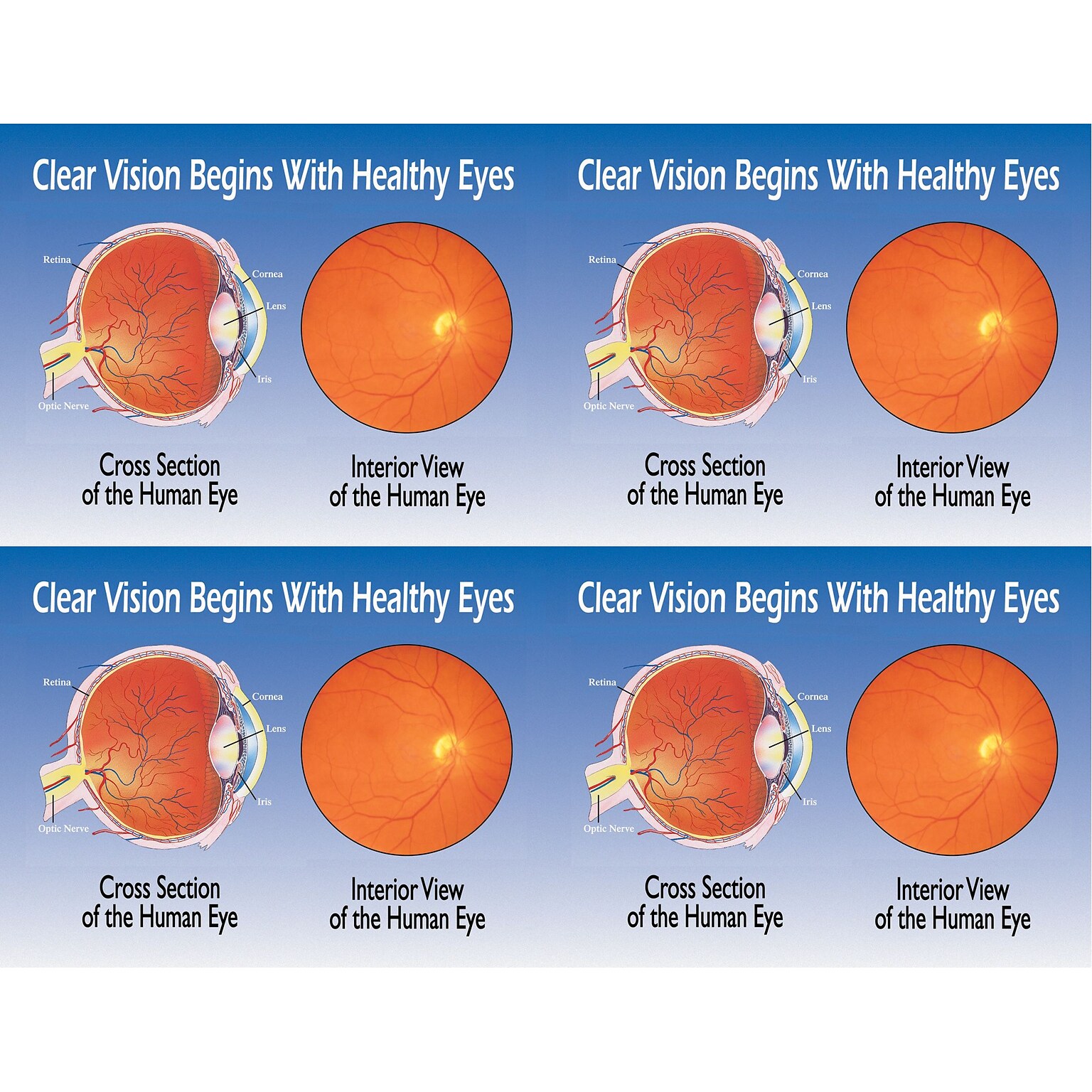 Preventive Postcards; for Laser Printer; Eye Cross Section/ Interior, 100/Pk