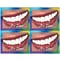 Cosmetic Dentistry Postcards; for Laser Printer; Its Time...Smile Deluxe, 100/Pk