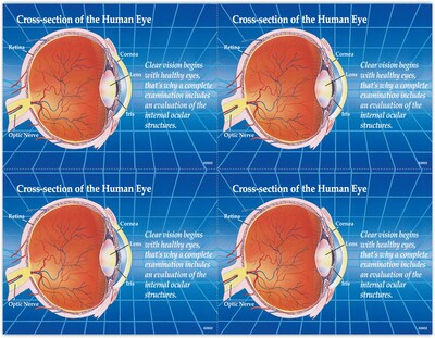 Preventive Postcards; for Laser Printer; Cross Section of Eye, 100/Pk