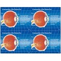 Preventive Postcards; for Laser Printer; Cross Section of Eye, 100/Pk
