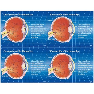 Preventive Postcards; for Laser Printer; Cross Section of Eye