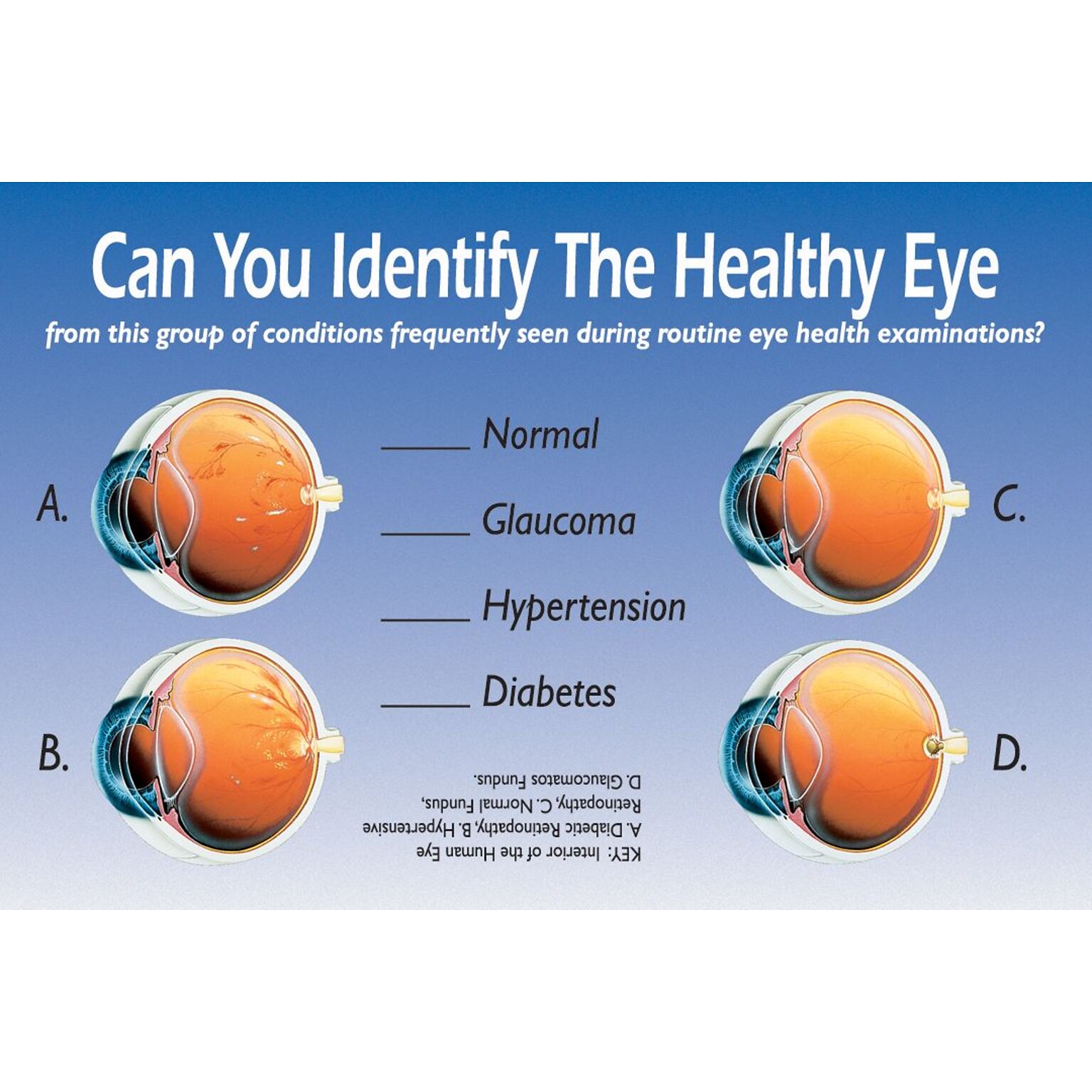 Patient Interactive Postcards; for Laser Printer; Identify Healthy Eye, 100/Pk