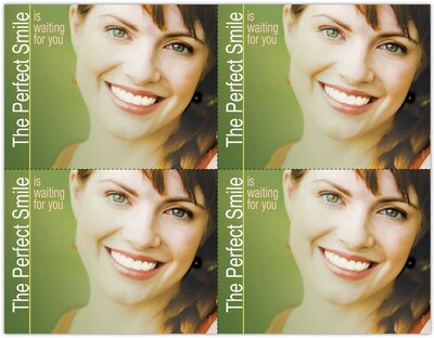 Photo Image Postcards; for Laser Printer; Perfect Smile Waiting, 100/Pk